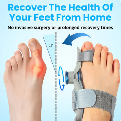 🔥💥 Flash Sale: 50% off first 50 orders!  AlignToe Pro – Bunion Pain Relief No Surgery Required | Walk, Run & Stand in Comfort